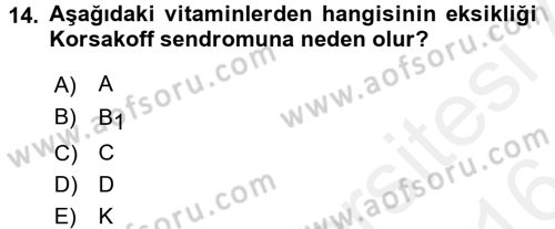 Beslenmenin Temel İlkeleri Dersi 2015 - 2016 Yılı (Vize) Ara Sınav Soruları 14. Soru