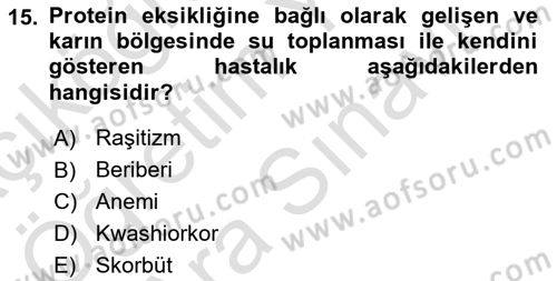 Beslenmenin Temel İlkeleri Dersi 2025 - 2026 Yılı (Vize) Ara Sınav Soruları 15. Soru