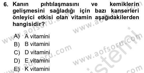 Beslenmenin Temel İlkeleri Dersi 2025 - 2026 Yılı (Vize) Ara Sınav Soruları 6. Soru