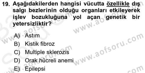 Çocuk Gelişimde Normal Ve Atipik Gelişim Dersi 2017 - 2018 Yılı (Final) Dönem Sonu Sınavı 19. Soru