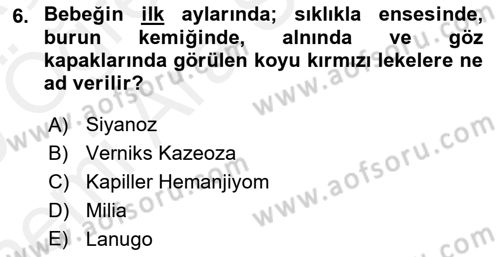 Çocuk Gelişimde Normal Ve Atipik Gelişim Dersi 2018 - 2019 Yılı (Vize) Ara Sınavı 6. Soru