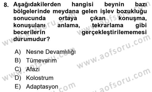Çocuk Gelişimi Dersi 2022 - 2023 Yılı Yaz Okulu Sınav Soruları 8. Soru