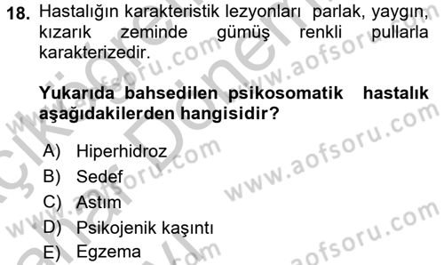 Çatışma ve Stres Yönetimi 2 Dersi 2016 - 2017 Yılı (Vize) Ara Sınav Soruları 18. Soru