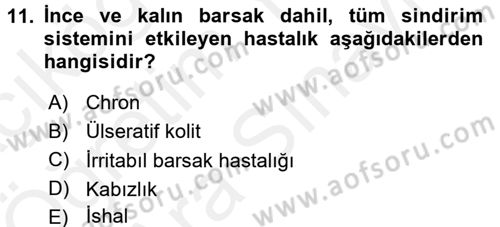 Çatışma ve Stres Yönetimi 2 Dersi 2017 - 2018 Yılı (Vize) Ara Sınav Soruları 11. Soru