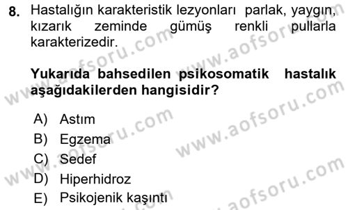 Çatışma ve Stres Yönetimi 2 Dersi 2018 - 2019 Yılı Yaz Okulu Sınav Soruları 8. Soru