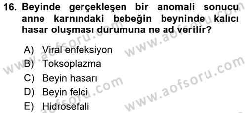 Bakıma Gereksinimi Olan Engelli Bireyler 1 Dersi 2020 - 2021 Yılı Yaz Okulu Sınav Soruları 16. Soru