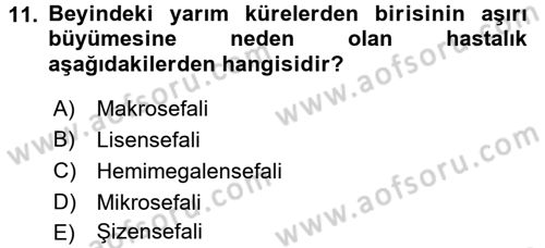 Bakıma Gereksinimi Olan Engelli Bireyler 2 Dersi 2017 - 2018 Yılı (Final) Dönem Sonu Sınav Soruları 11. Soru