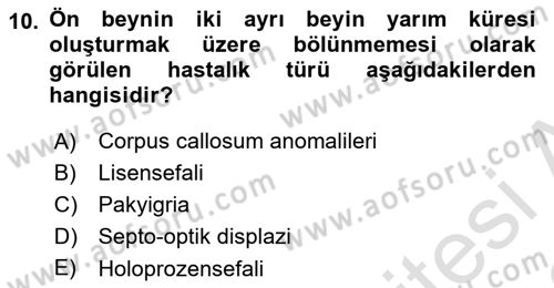 Bakıma Gereksinimi Olan Engelli Bireyler 2 Dersi 2021 - 2022 Yılı Yaz Okulu Sınav Soruları 10. Soru