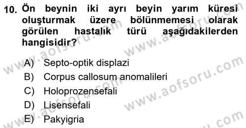 Bakıma Gereksinimi Olan Engelli Bireyler 2 Dersi 2023 - 2024 Yılı Yaz Okulu Sınav Soruları 10. Soru