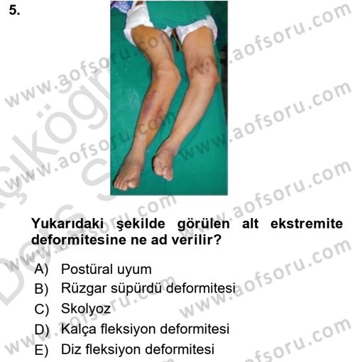 Temel Bakım ve Rehabilitasyon 2 Dersi 2018 - 2019 Yılı 3 Ders Sınav Soruları 5. Soru