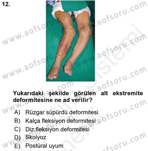 Temel Bakım ve Rehabilitasyon 2 Dersi Ara Sınavı Deneme Sınav Soruları 12. Soru