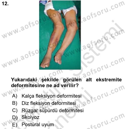Temel Bakım ve Rehabilitasyon 2 Dersi 2021 - 2022 Yılı (Final) Dönem Sonu Sınav Soruları 12. Soru