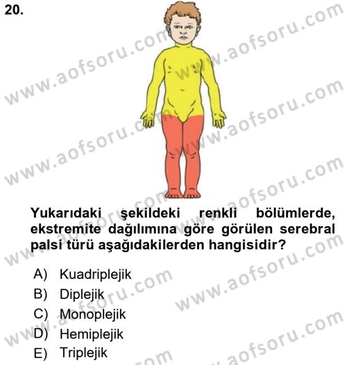 Ortopedik Rehabilitasyon Dersi 2018 - 2019 Yılı (Vize) Ara Sınav Soruları 20. Soru