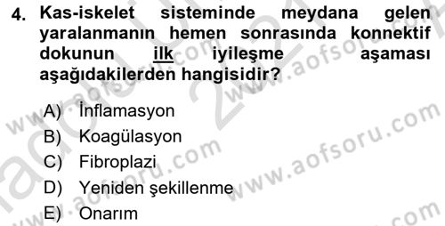 Ortopedik Rehabilitasyon Dersi 2021 - 2022 Yılı (Vize) Ara Sınav Soruları 4. Soru