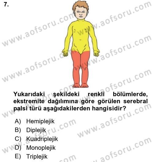 Ortopedik Rehabilitasyon Dersi 2022 - 2023 Yılı Yaz Okulu Sınav Soruları 7. Soru
