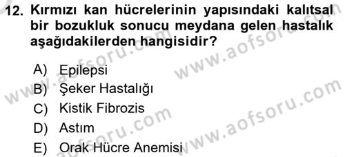 Gelişimsel Yetersizliklerin Bakım ve Rehabilitasyonu Dersi 2020 - 2021 Yılı Yaz Okulu Sınav Soruları 12. Soru