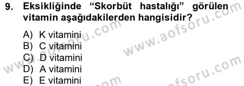Çocuk ve Ergen Bakımı Dersi 2012 - 2013 Yılı (Vize) Ara Sınav Soruları 9. Soru