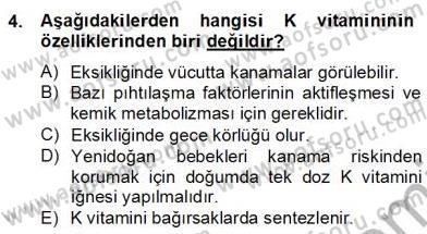 Çocuk ve Ergen Bakımı Dersi 2012 - 2013 Yılı (Final) Dönem Sonu Sınav Soruları 4. Soru