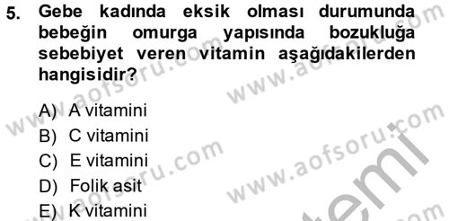 Çocuk ve Ergen Bakımı Dersi 2013 - 2014 Yılı (Vize) Ara Sınav Soruları 5. Soru