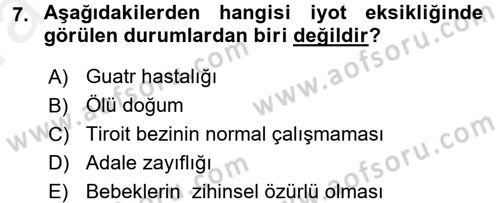 Çocuk ve Ergen Bakımı Dersi 2015 - 2016 Yılı (Vize) Ara Sınav Soruları 7. Soru
