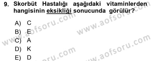 Çocuk ve Ergen Bakımı Dersi 2015 - 2016 Yılı (Vize) Ara Sınav Soruları 9. Soru