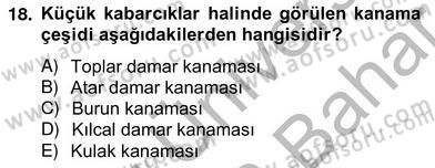 Ev Kazaları ve İlk Yardım Dersi 2012 - 2013 Yılı (Vize) Ara Sınav Soruları 18. Soru
