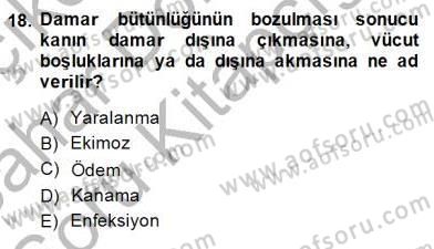 Ev Kazaları ve İlk Yardım Dersi 2014 - 2015 Yılı (Vize) Ara Sınav Soruları 18. Soru