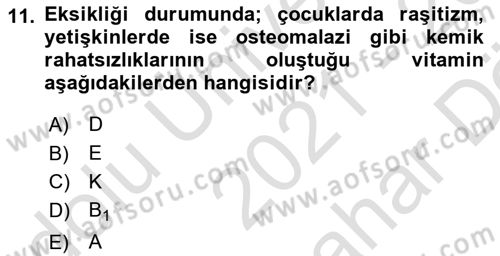 Sağlıklı Yaşam Dersi 2021 - 2022 Yılı (Vize) Ara Sınav Soruları 11. Soru
