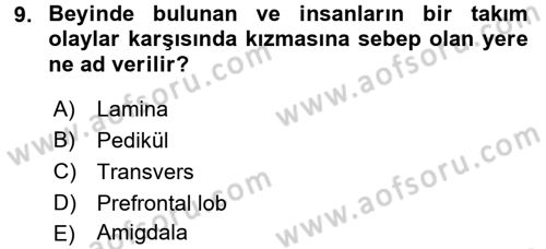 Etkili İletişim Teknikleri Dersi 2016 - 2017 Yılı 3 Ders Sınav Soruları 9. Soru