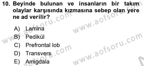 Etkili İletişim Teknikleri Dersi 2016 - 2017 Yılı (Vize) Ara Sınav Soruları 10. Soru