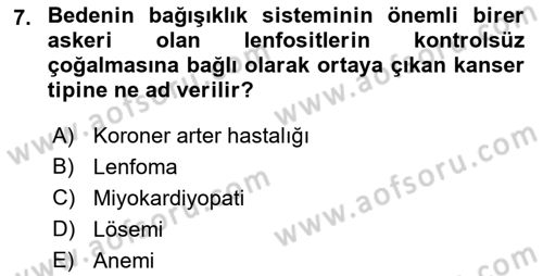 İş Sağlığı ve Güvenliğinin Temelleri Dersi 2022 - 2023 Yılı Yaz Okulu Sınav Soruları 7. Soru
