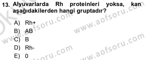 İş Hijyeni ve Ergonomi Dersi 2020 - 2021 Yılı Yaz Okulu Sınav Soruları 13. Soru