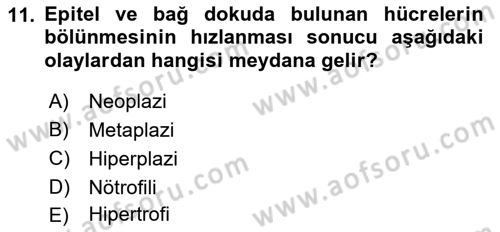 Temel Veteriner Parazitoloji Dersi 2016 - 2017 Yılı (Final) Dönem Sonu Sınav Soruları 11. Soru