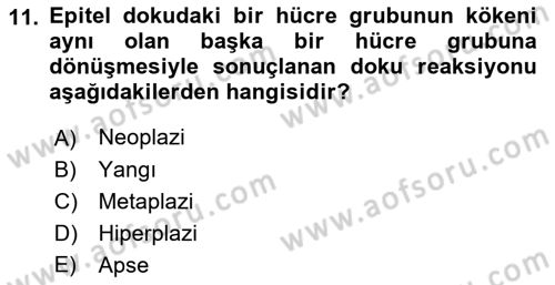 Temel Veteriner Parazitoloji Dersi 2017 - 2018 Yılı (Final) Dönem Sonu Sınav Soruları 11. Soru