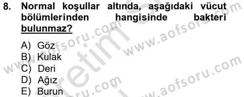 Hijyen ve Sanitasyon Dersi 2013 - 2014 Yılı Tek Ders Sınav Soruları 8. Soru