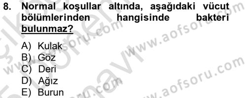 Hijyen ve Sanitasyon Dersi 2014 - 2015 Yılı Tek Ders Sınav Soruları 8. Soru