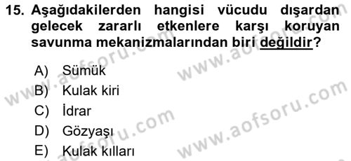 Hijyen ve Sanitasyon Dersi 2023 - 2024 Yılı (Vize) Ara Sınav Soruları 15. Soru