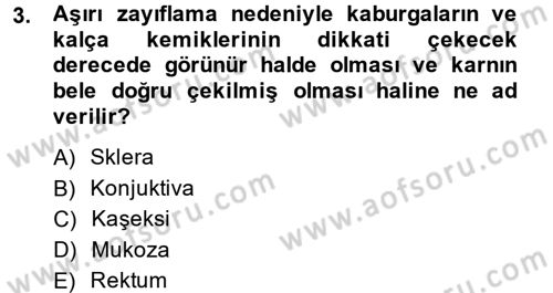 Temel Klinik Bilgisi Dersi 2013 - 2014 Yılı (Final) Dönem Sonu Sınav Soruları 3. Soru