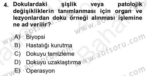 Temel Klinik Bilgisi Dersi 2018 - 2019 Yılı (Vize) Ara Sınav Soruları 4. Soru