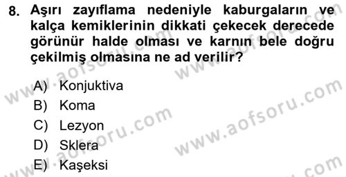 Temel Klinik Bilgisi Dersi 2024 - 2025 Yılı (Vize) Ara Sınav Soruları 8. Soru