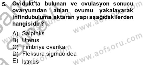 Doğum Bilgisi ve Suni Tohumlama Dersi 2012 - 2013 Yılı (Vize) Ara Sınav Soruları 5. Soru