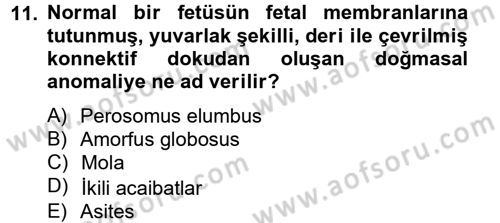 Doğum Bilgisi ve Suni Tohumlama Dersi 2012 - 2013 Yılı (Final) Dönem Sonu Sınav Soruları 11. Soru