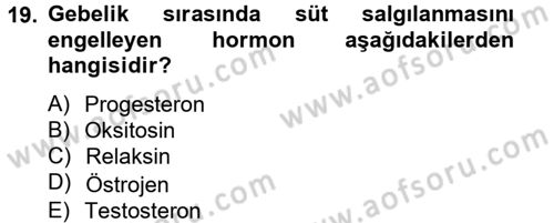 Doğum Bilgisi ve Suni Tohumlama Dersi 2012 - 2013 Yılı (Final) Dönem Sonu Sınav Soruları 19. Soru