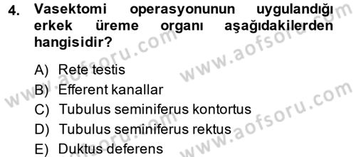 Doğum Bilgisi ve Suni Tohumlama Dersi 2013 - 2014 Yılı (Vize) Ara Sınav Soruları 4. Soru