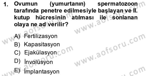 Doğum Bilgisi ve Suni Tohumlama Dersi 2013 - 2014 Yılı (Final) Dönem Sonu Sınav Soruları 1. Soru