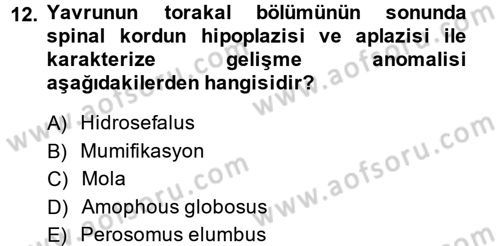 Doğum Bilgisi ve Suni Tohumlama Dersi 2013 - 2014 Yılı (Final) Dönem Sonu Sınav Soruları 12. Soru