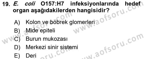 Gıda Güvenliğinin Temel Prensipleri Dersi 2016 - 2017 Yılı (Vize) Ara Sınav Soruları 19. Soru