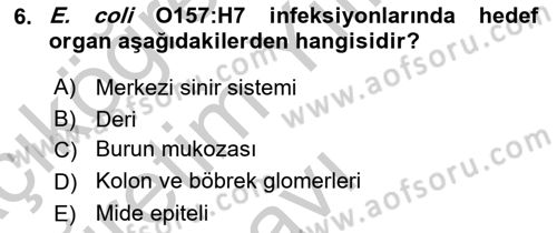 Gıda Güvenliğinin Temel Prensipleri Dersi 2018 - 2019 Yılı Yaz Okulu Sınav Soruları 6. Soru