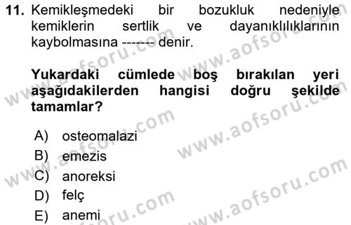 Gıda Güvenliğinin Temel Prensipleri Dersi 2023 - 2024 Yılı Yaz Okulu Sınav Soruları 11. Soru