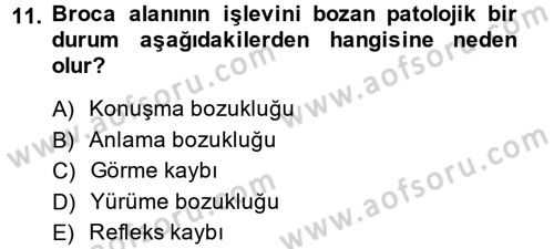Psikoloji Dersi 2014 - 2015 Yılı (Vize) Ara Sınav Soruları 11. Soru